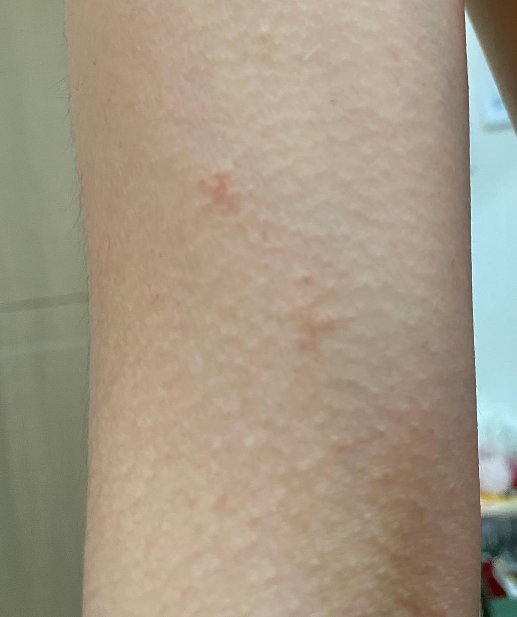 2번 째 사진