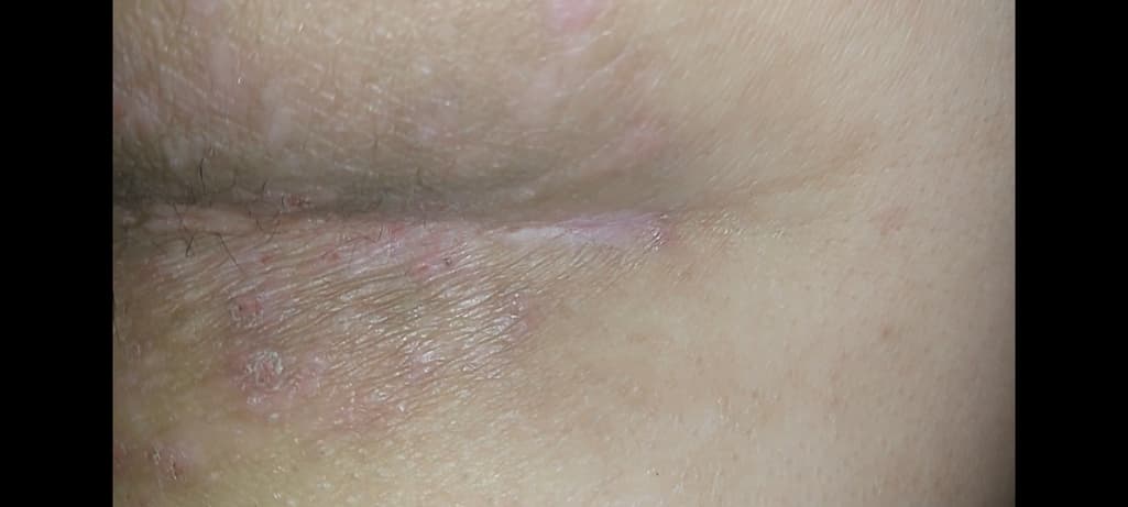 2번 째 사진