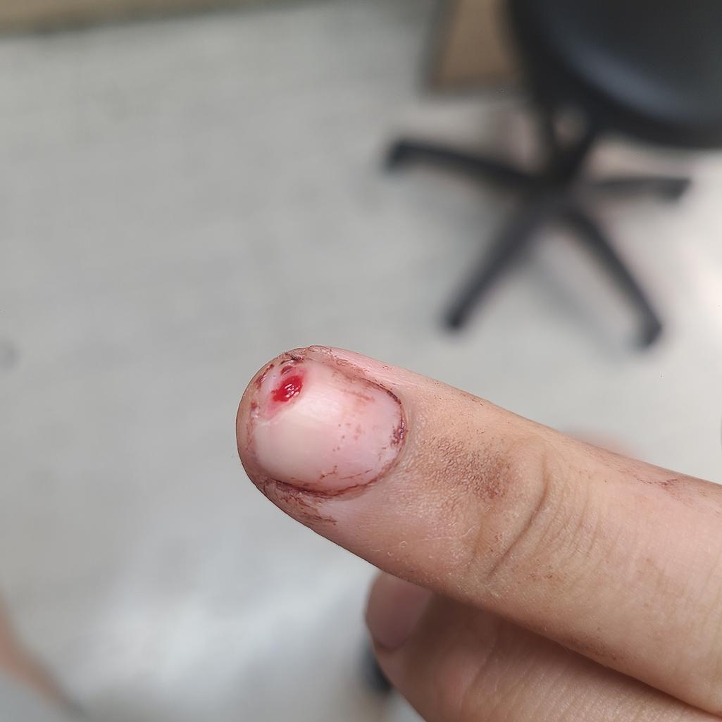 1번 째 사진