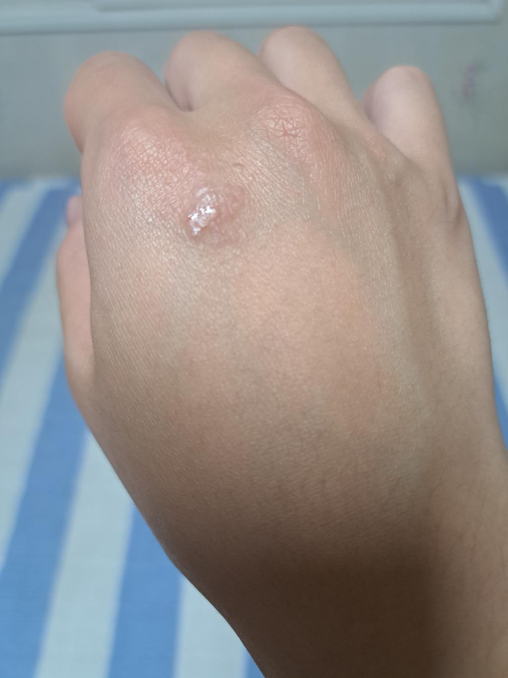 1번 째 사진