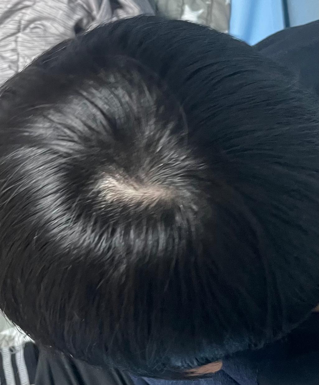 3번 째 사진