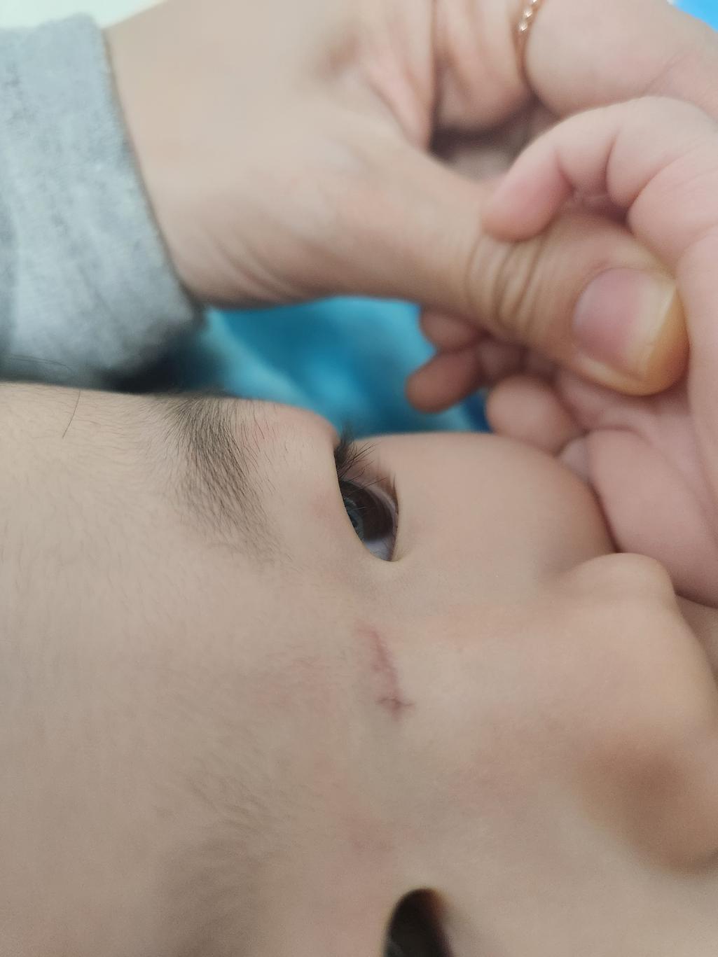 2번 째 사진