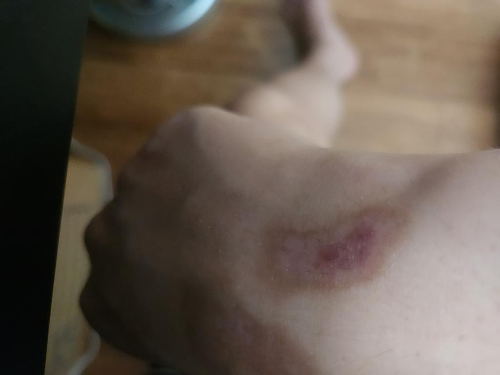 2번 째 사진