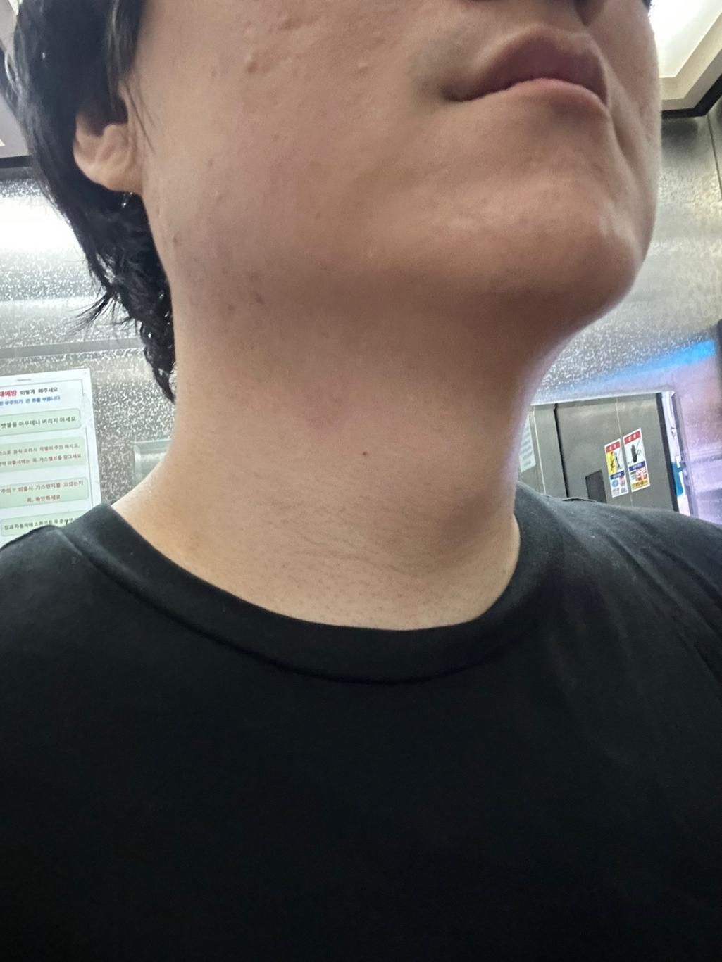 2번 째 사진