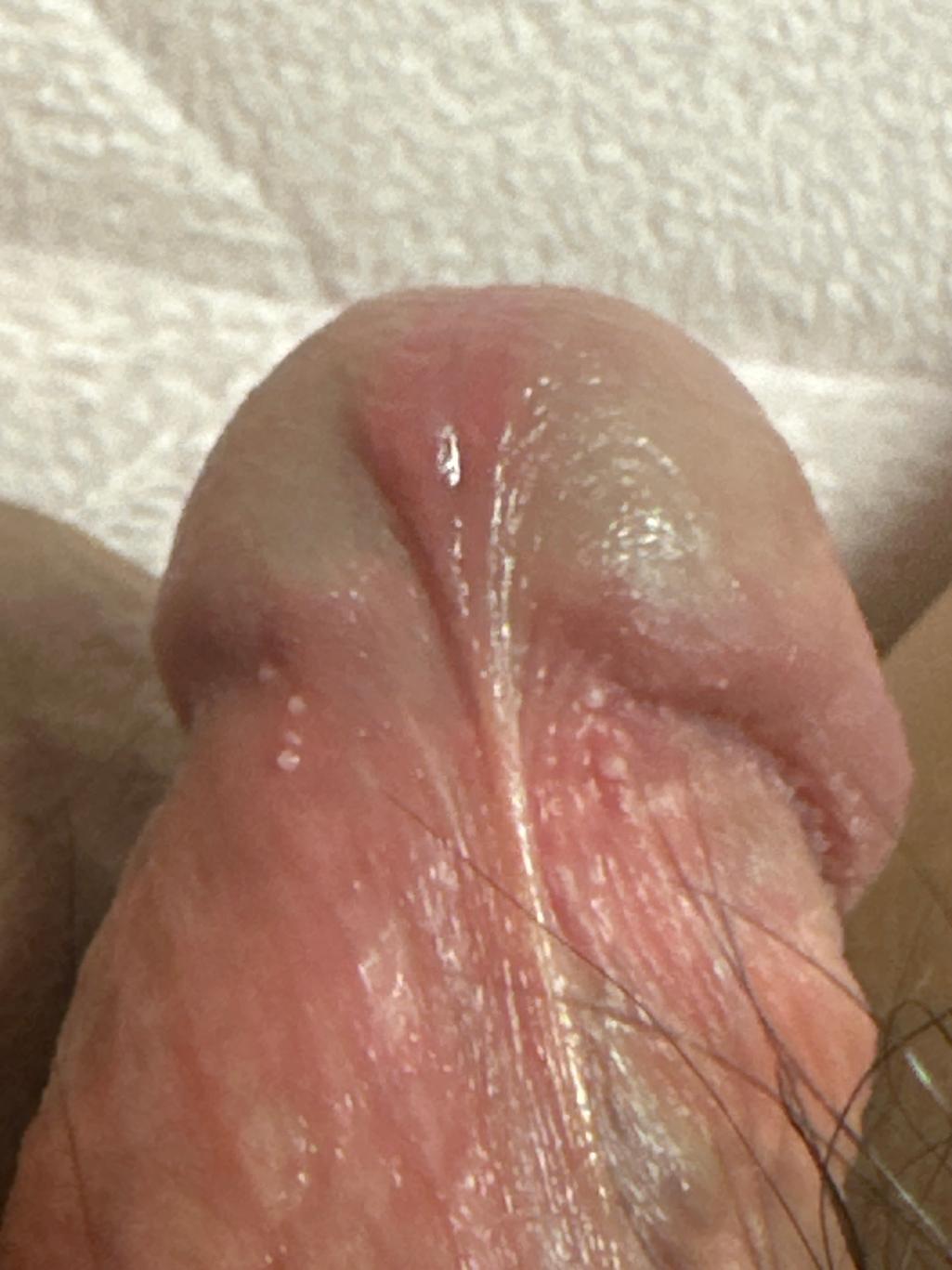 2번 째 사진
