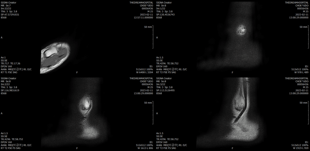 12번 째 사진