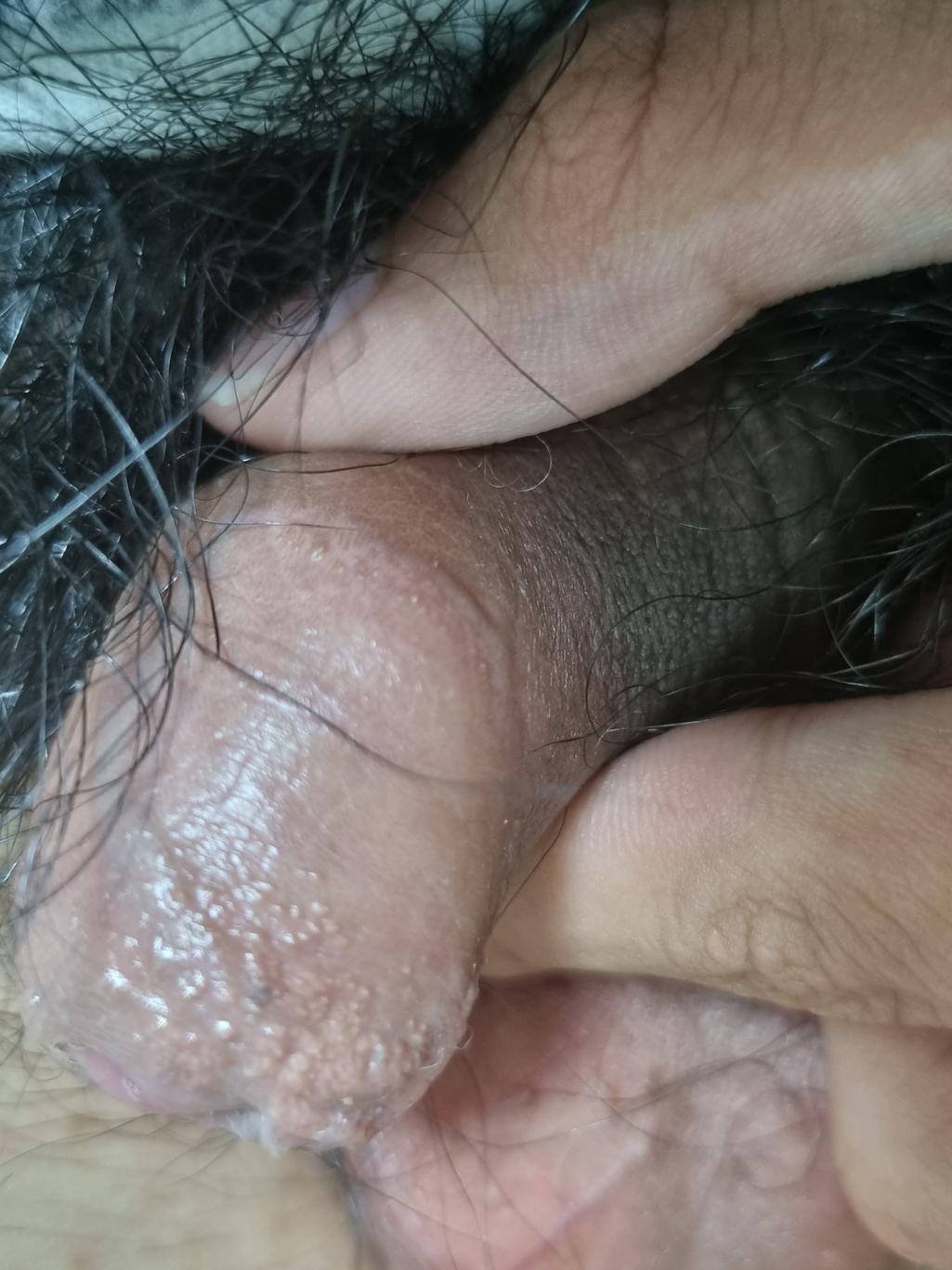 2번 째 사진