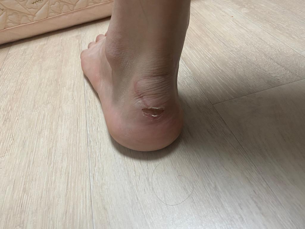 2번 째 사진
