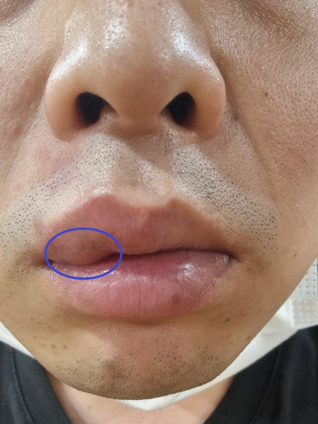 1번 째 사진