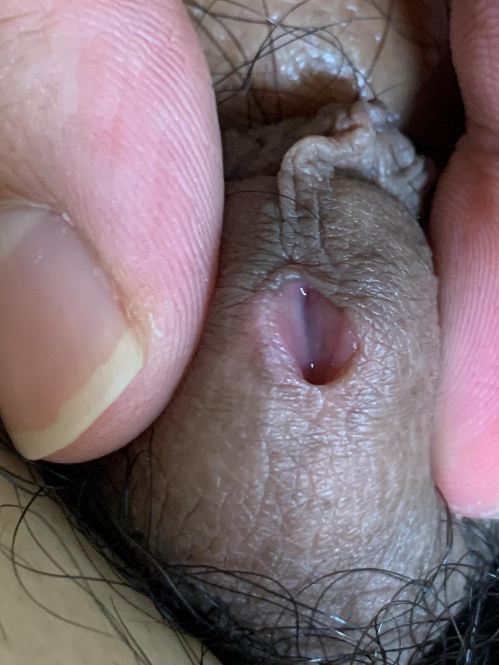 7번 째 사진