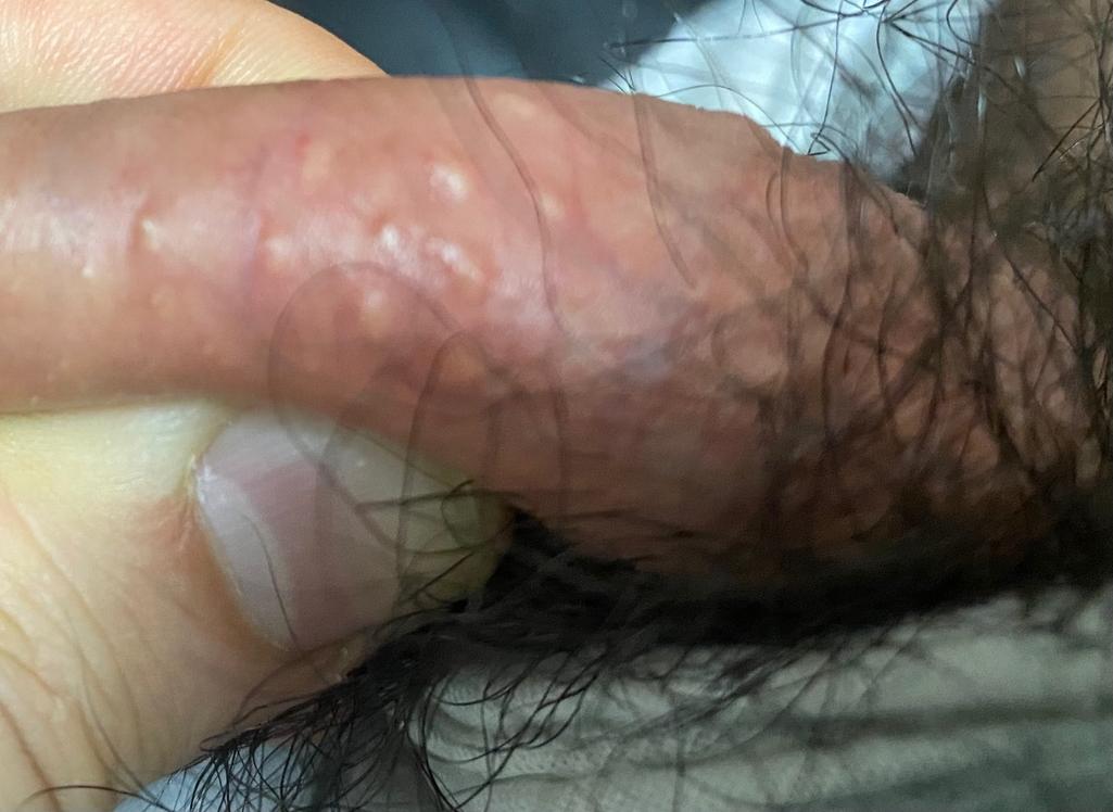 2번 째 사진
