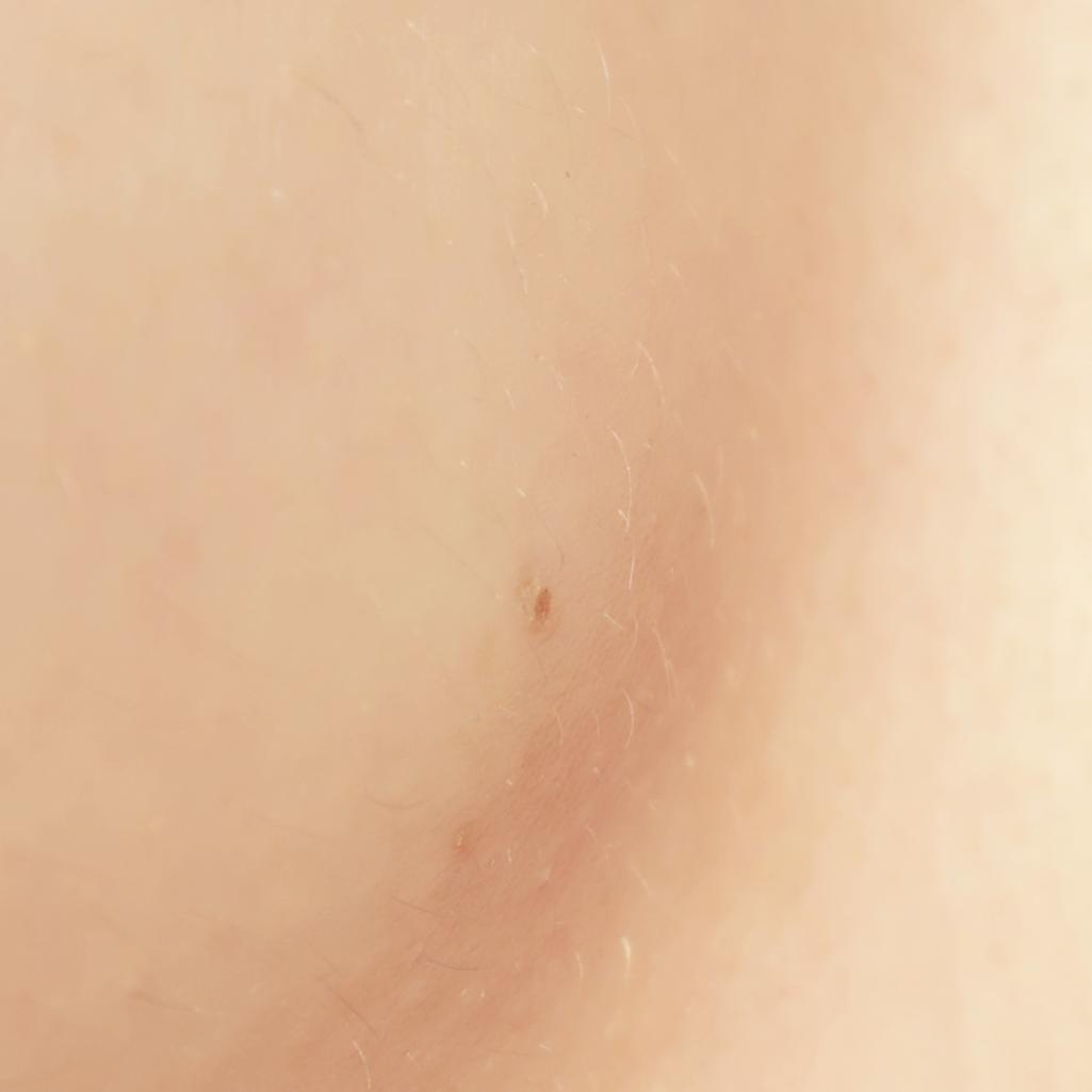 2번 째 사진