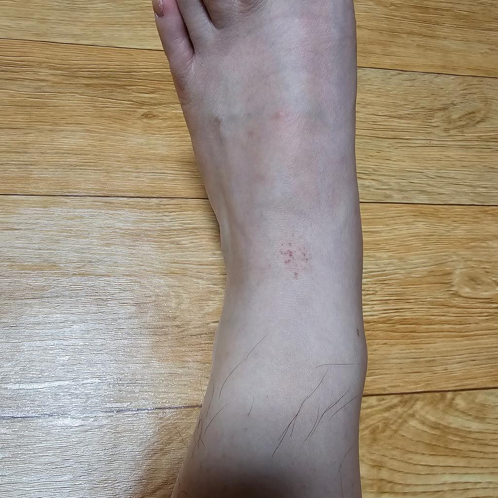 2번 째 사진