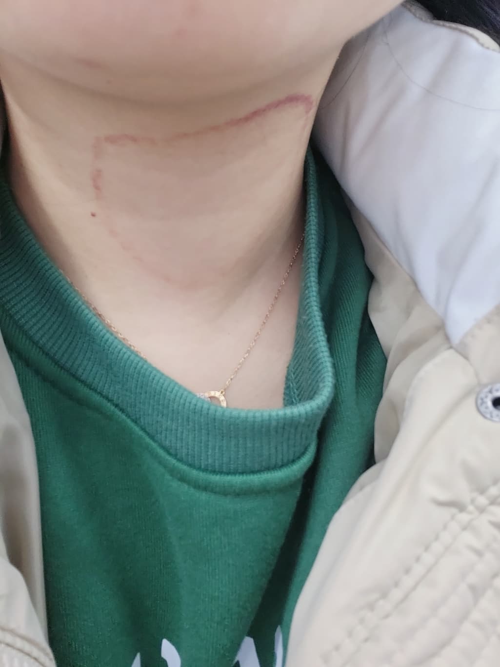 2번 째 사진