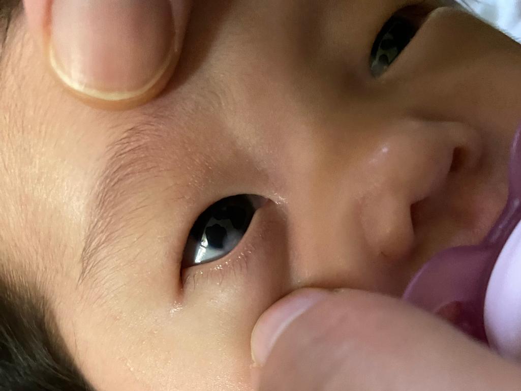 2번 째 사진