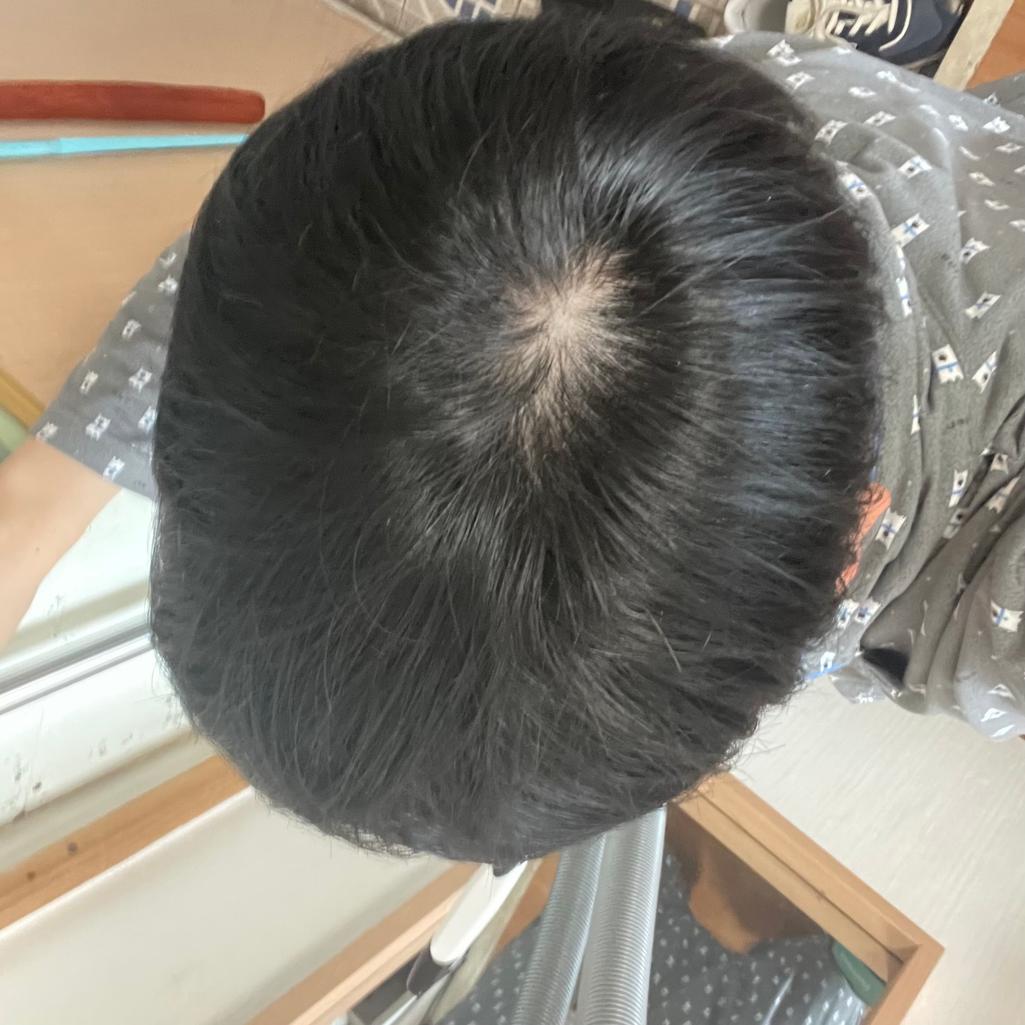 2번 째 사진