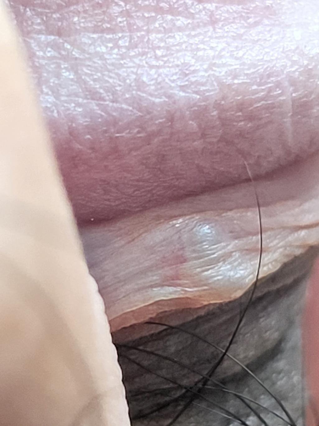 3번 째 사진