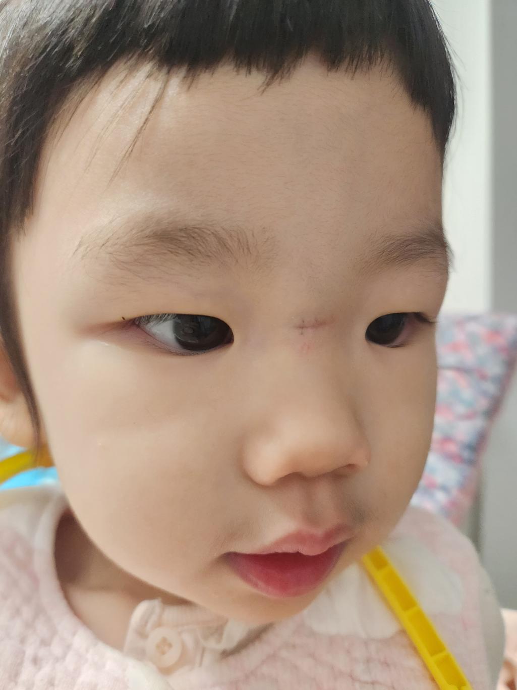 2번 째 사진