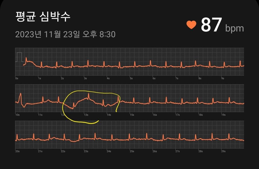 2번 째 사진