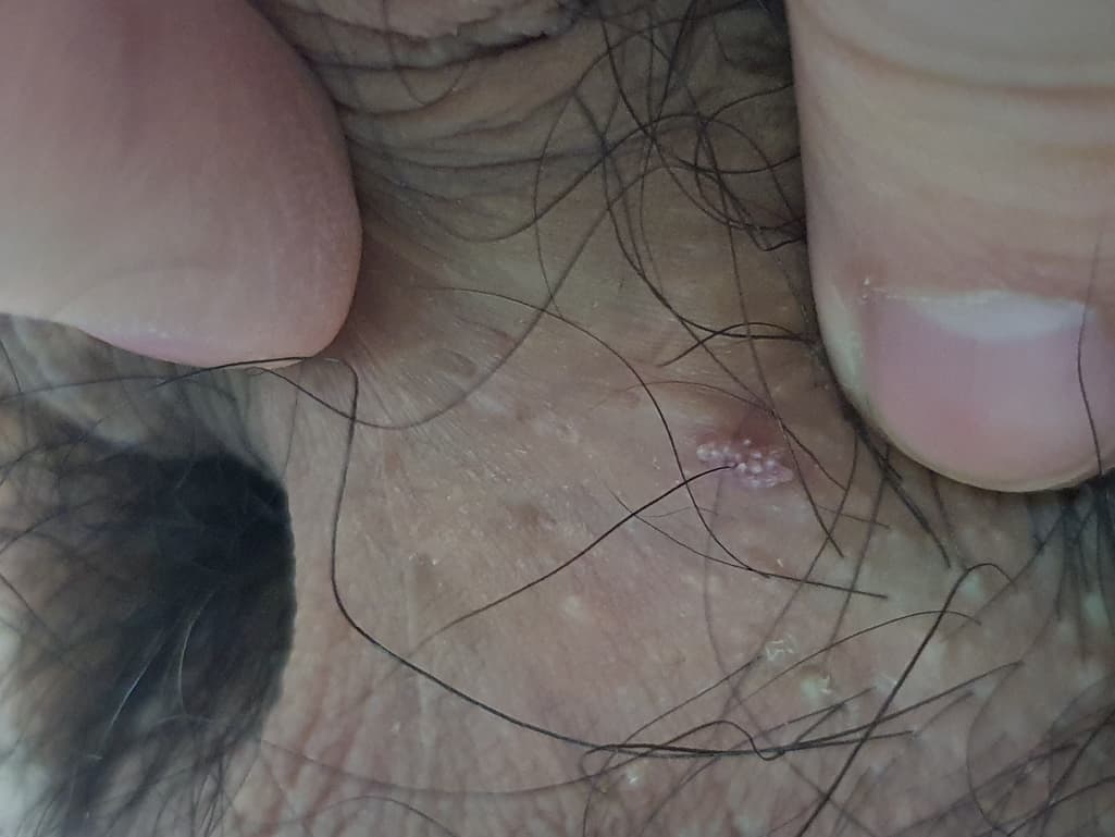 3번 째 사진
