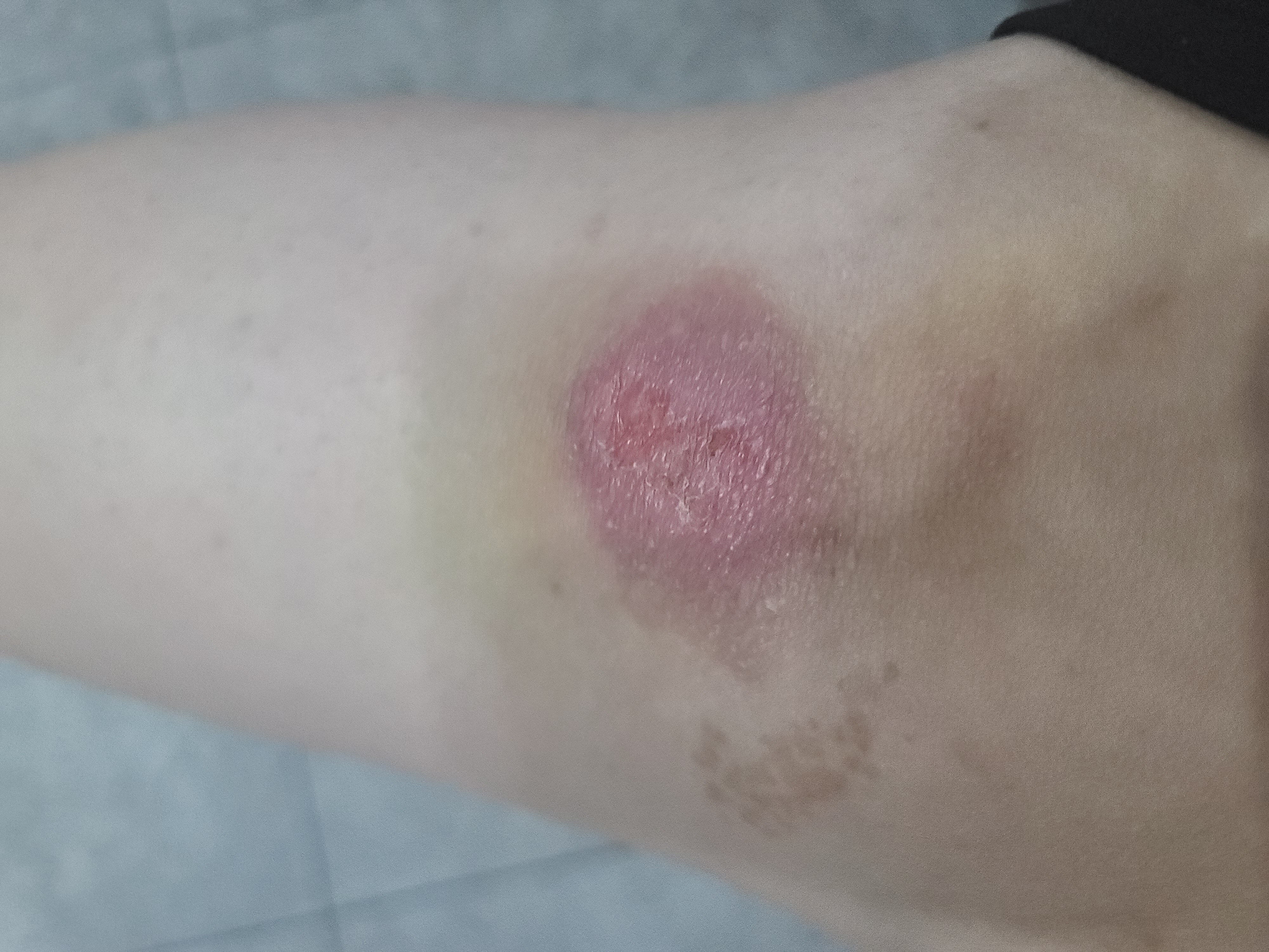 1번 째 사진