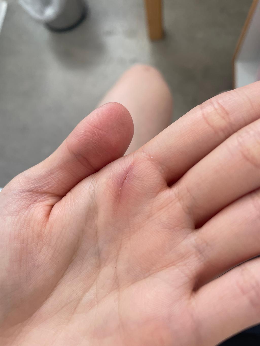 2번 째 사진