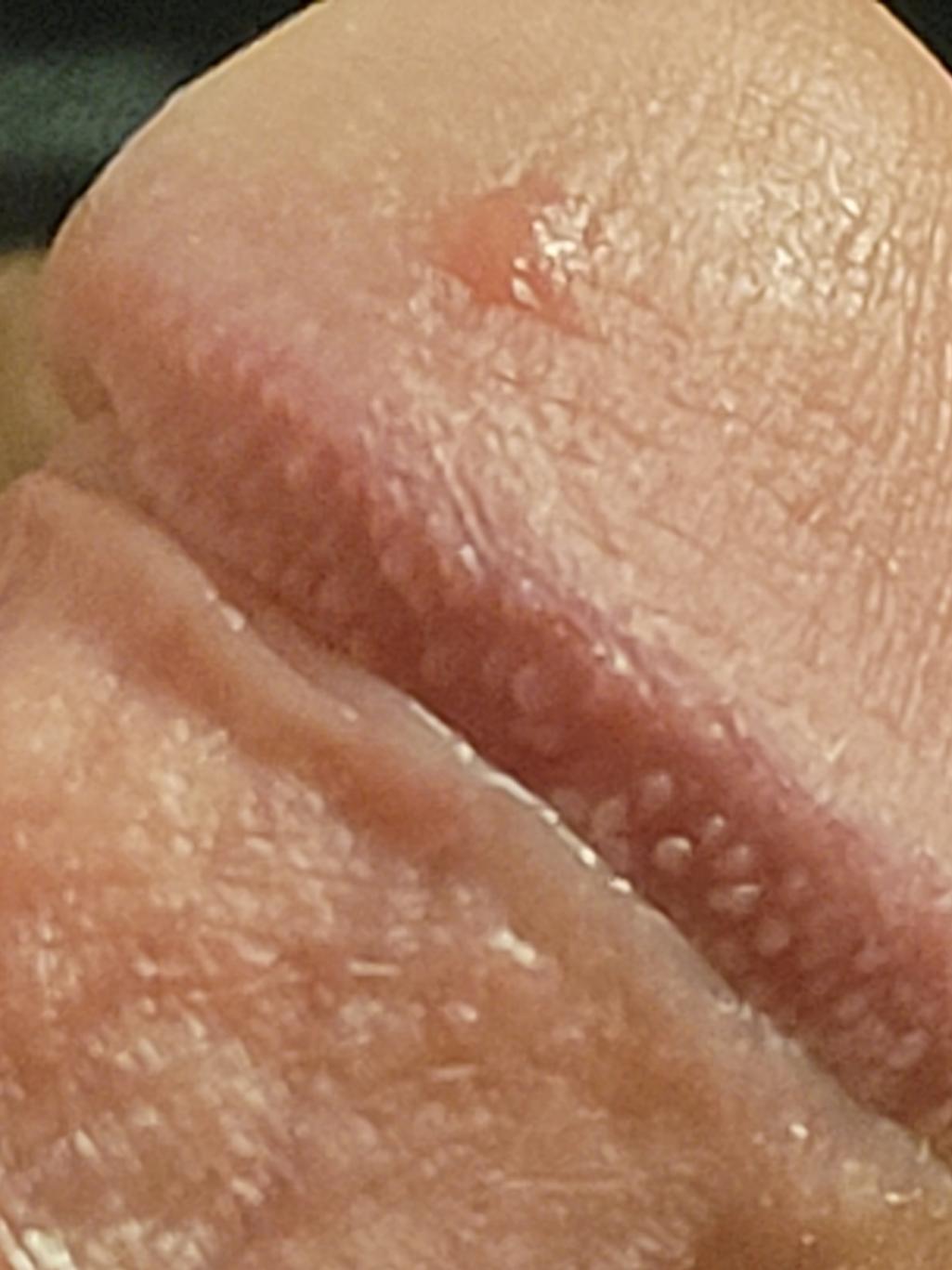 2번 째 사진