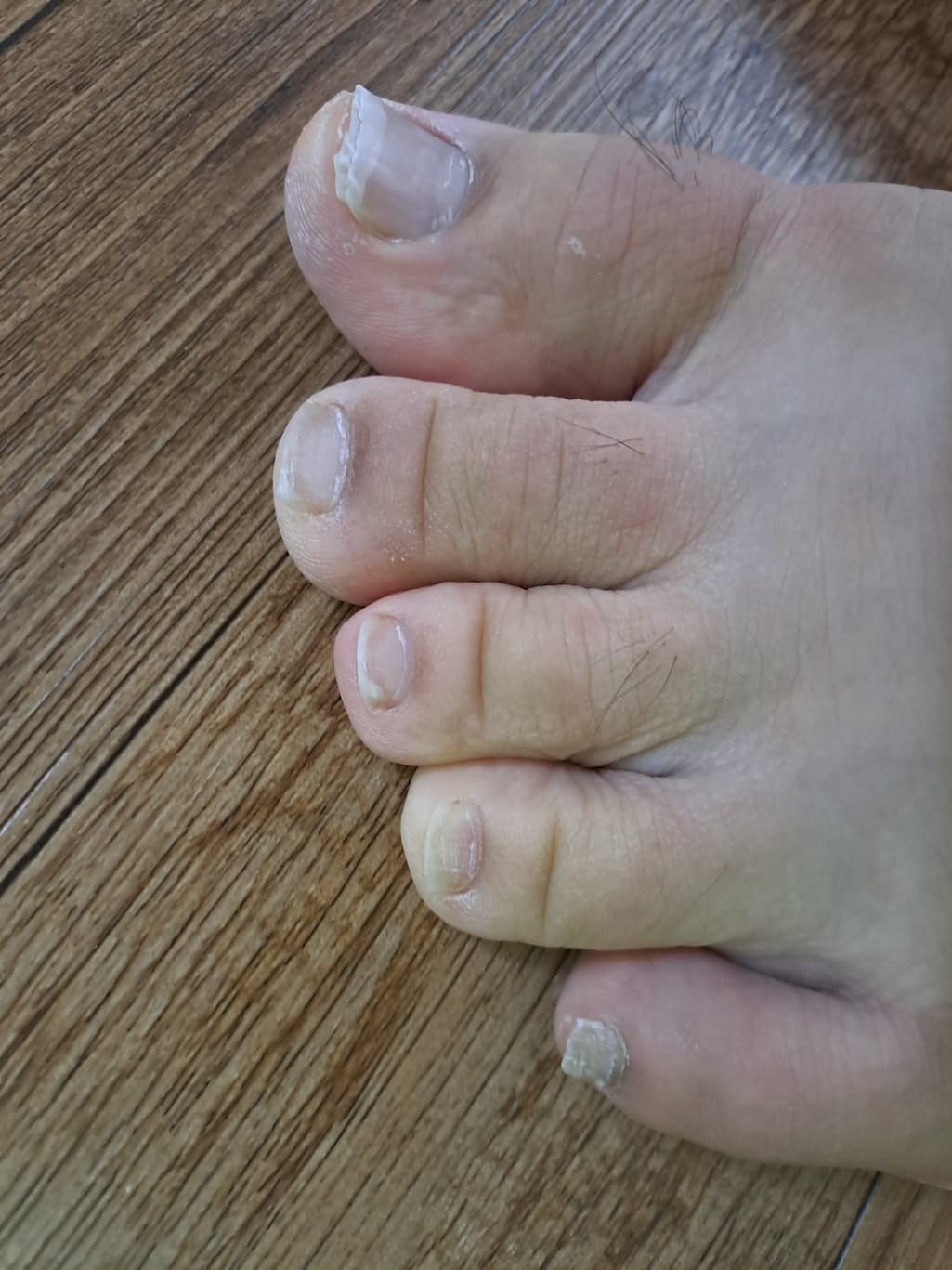 3번 째 사진