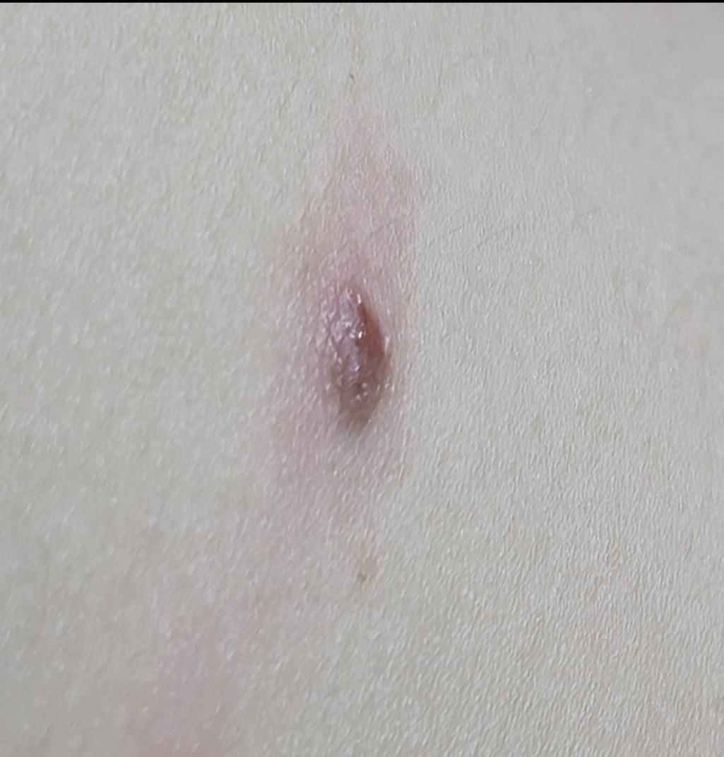 2번 째 사진