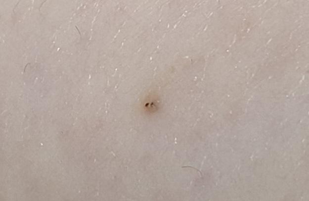 6번 째 사진