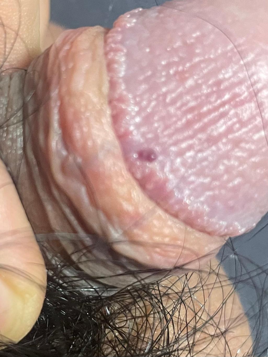 2번 째 사진