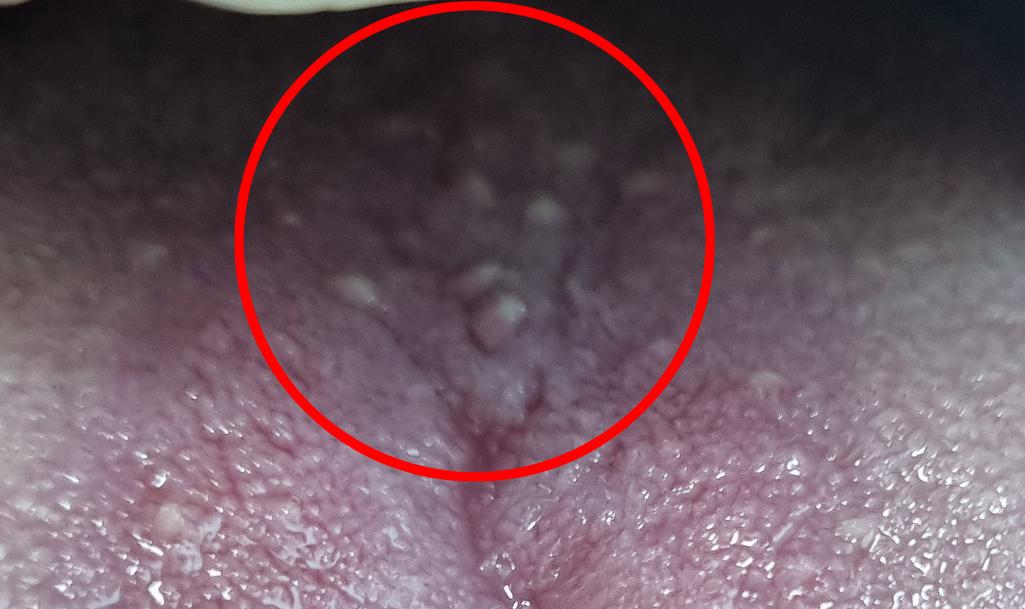 3번 째 사진