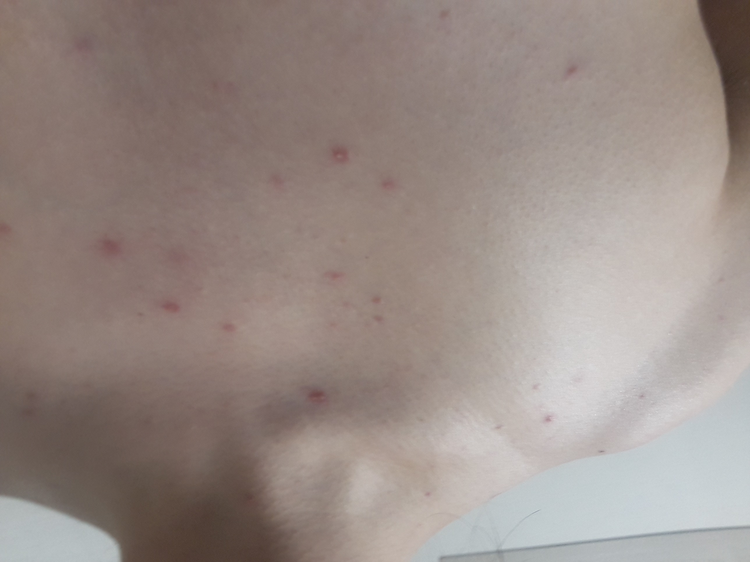 2번 째 사진
