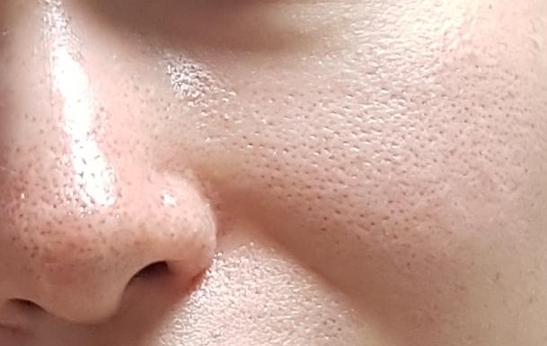 2번 째 사진