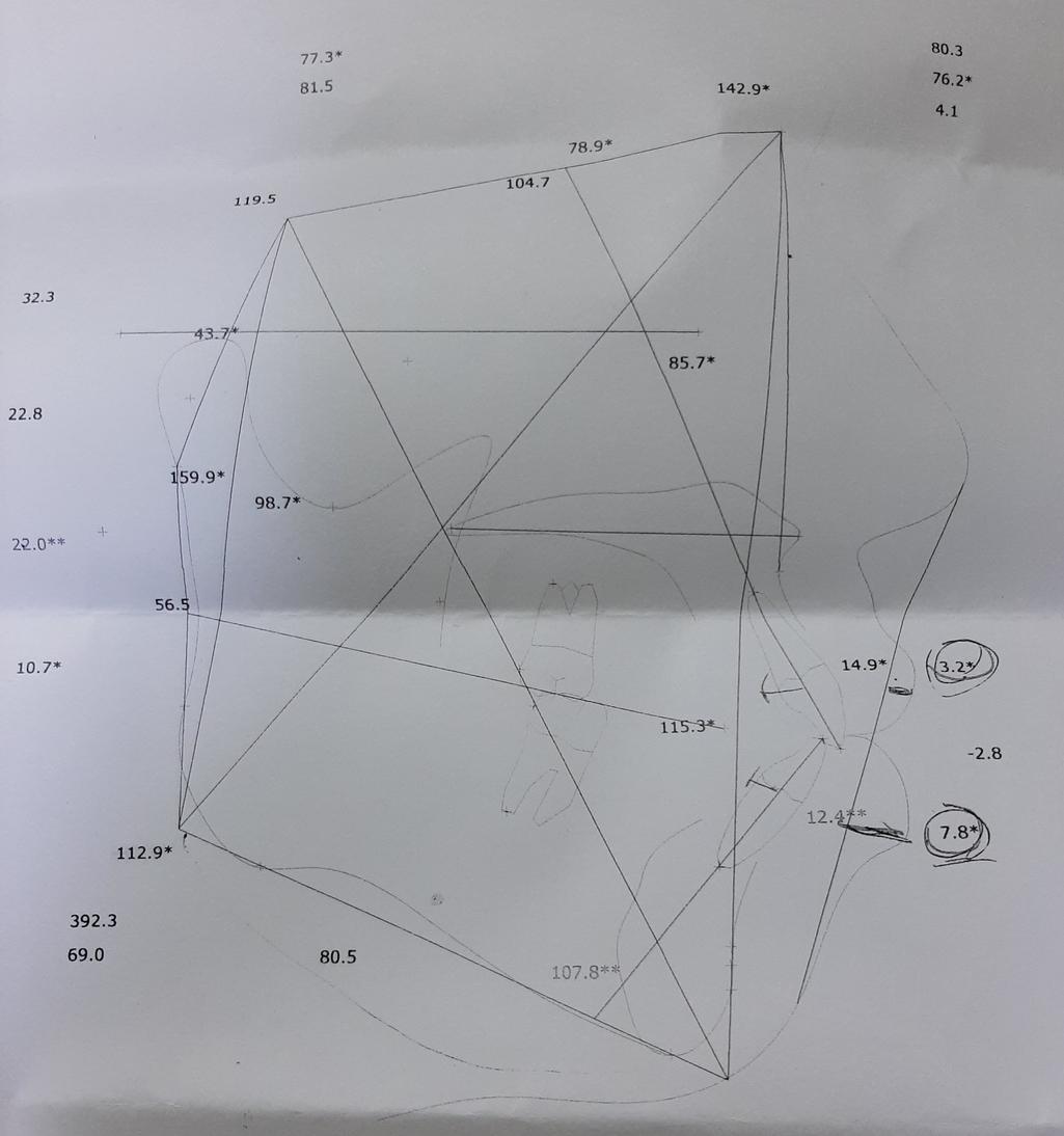 4번 째 사진