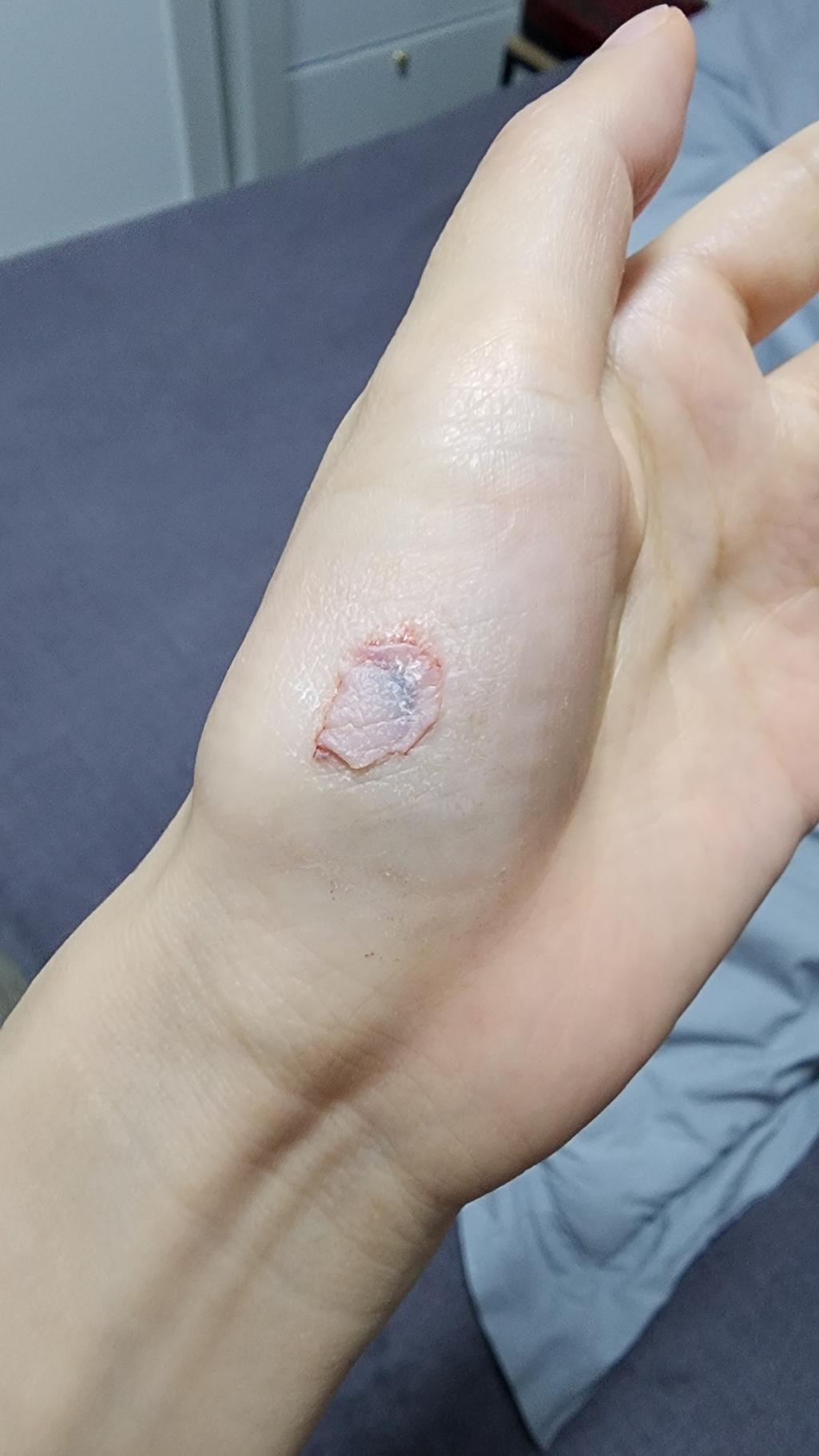 2번 째 사진