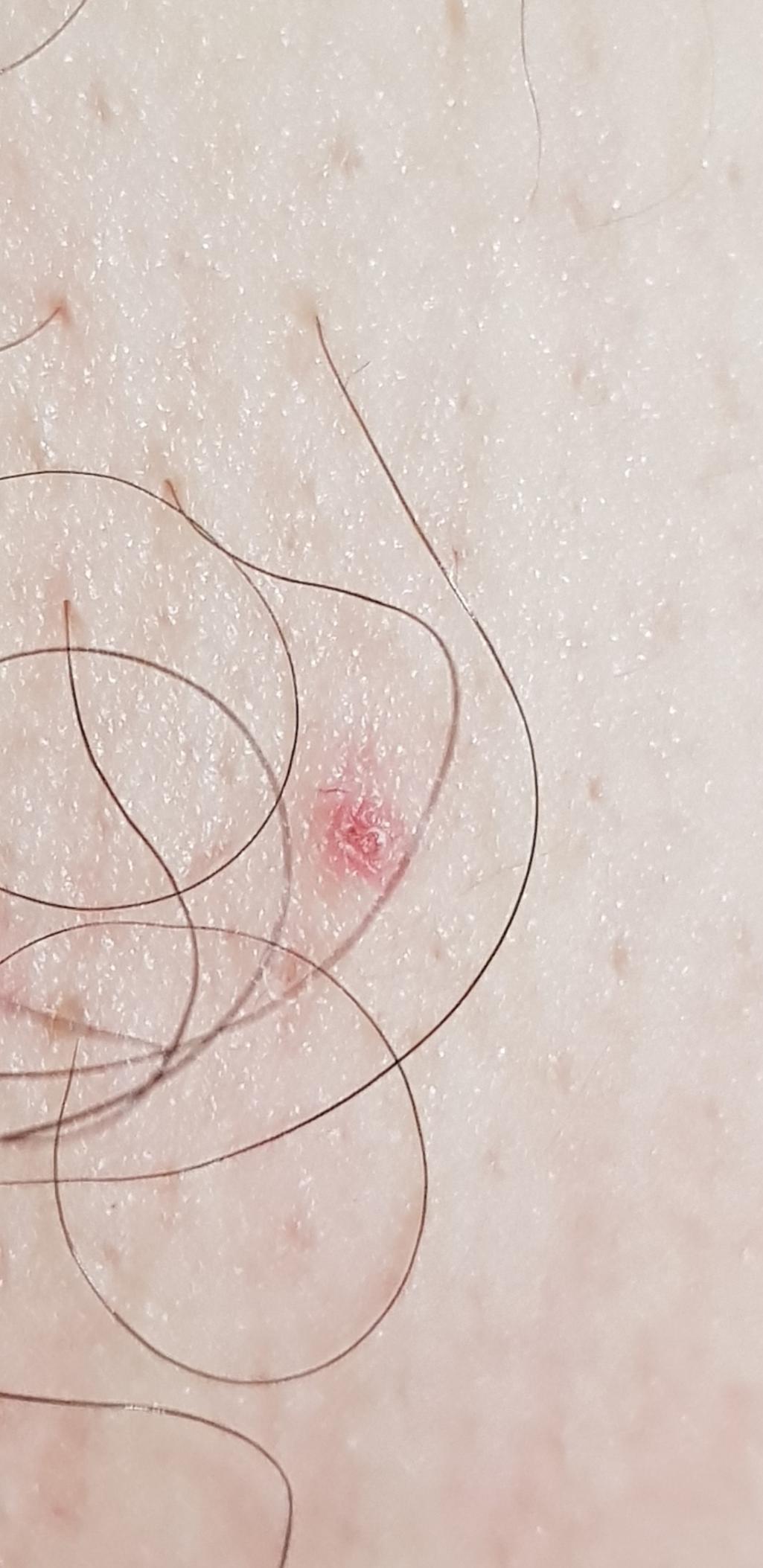 2번 째 사진