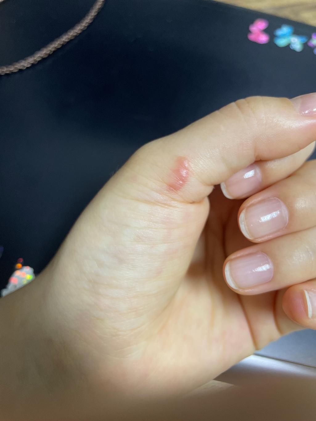 2번 째 사진