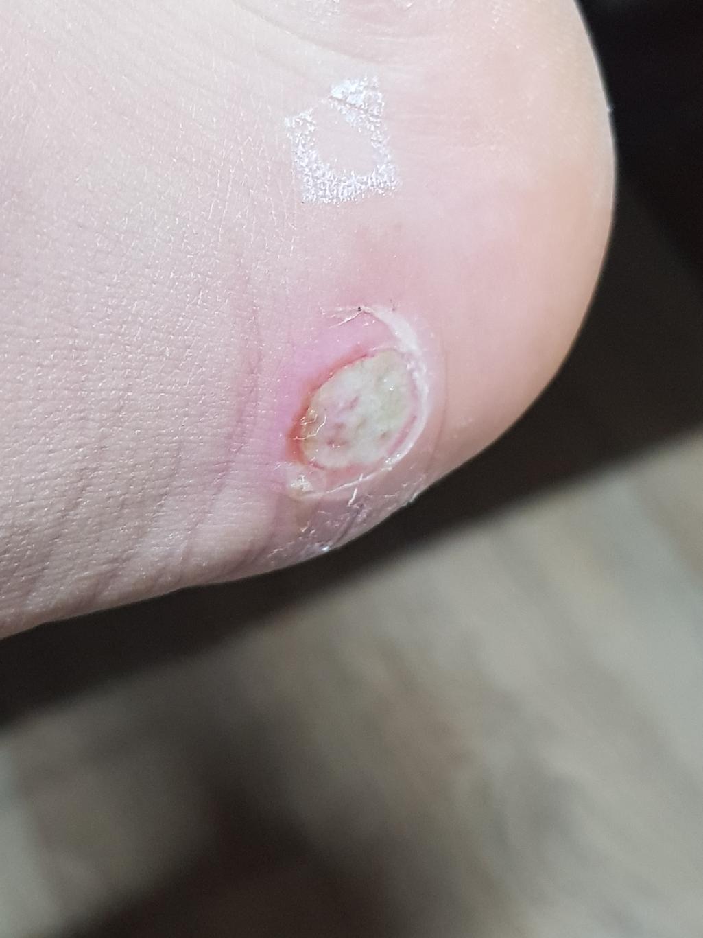 2번 째 사진