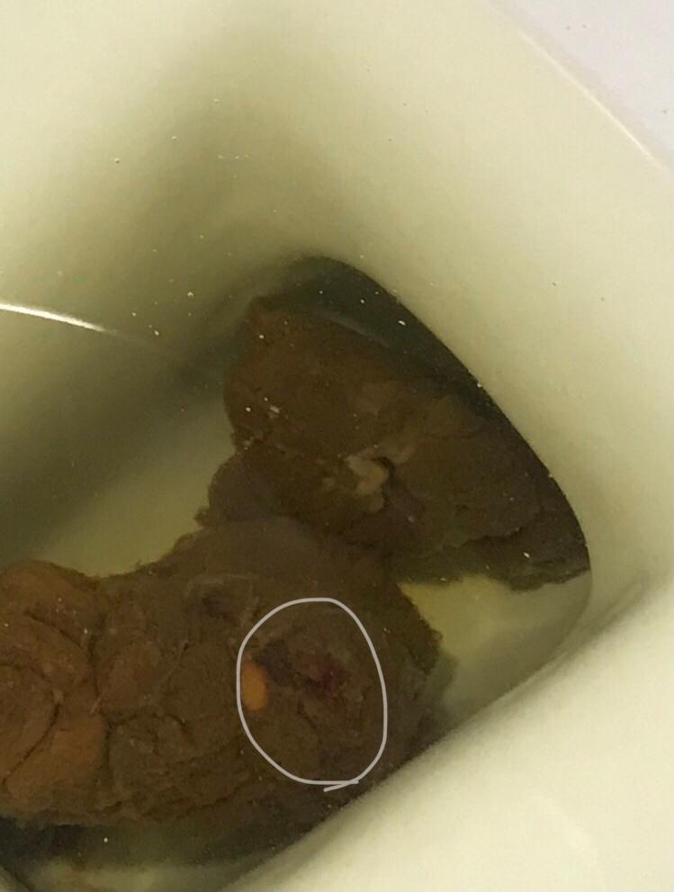 2번 째 사진