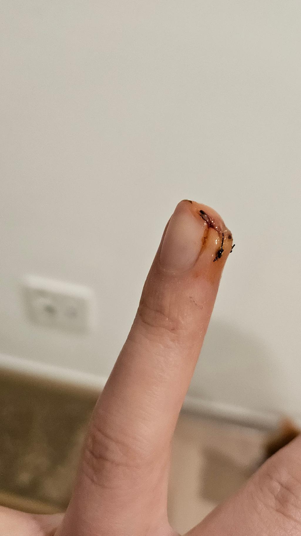 3번 째 사진