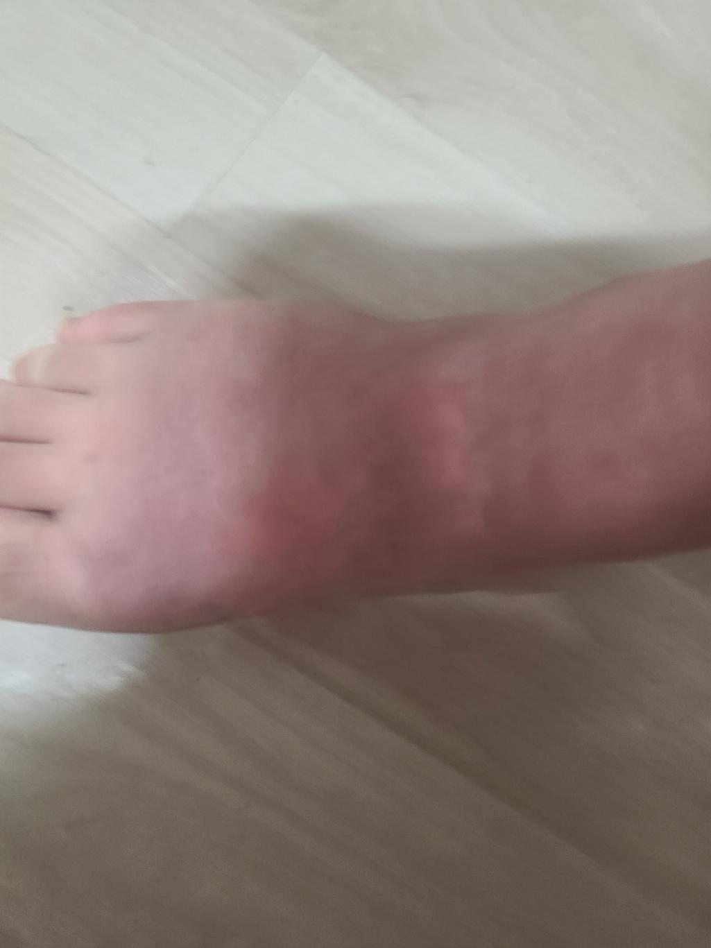 2번 째 사진