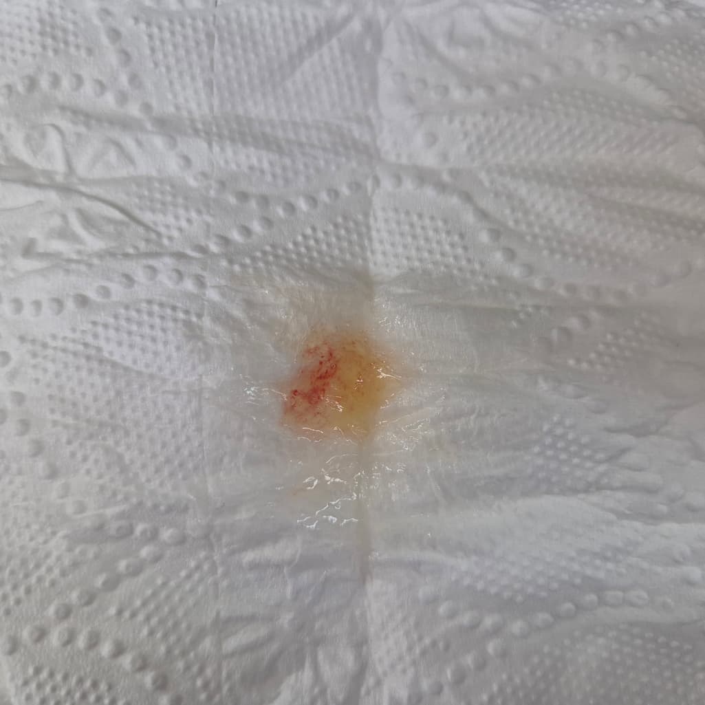 1번 째 사진