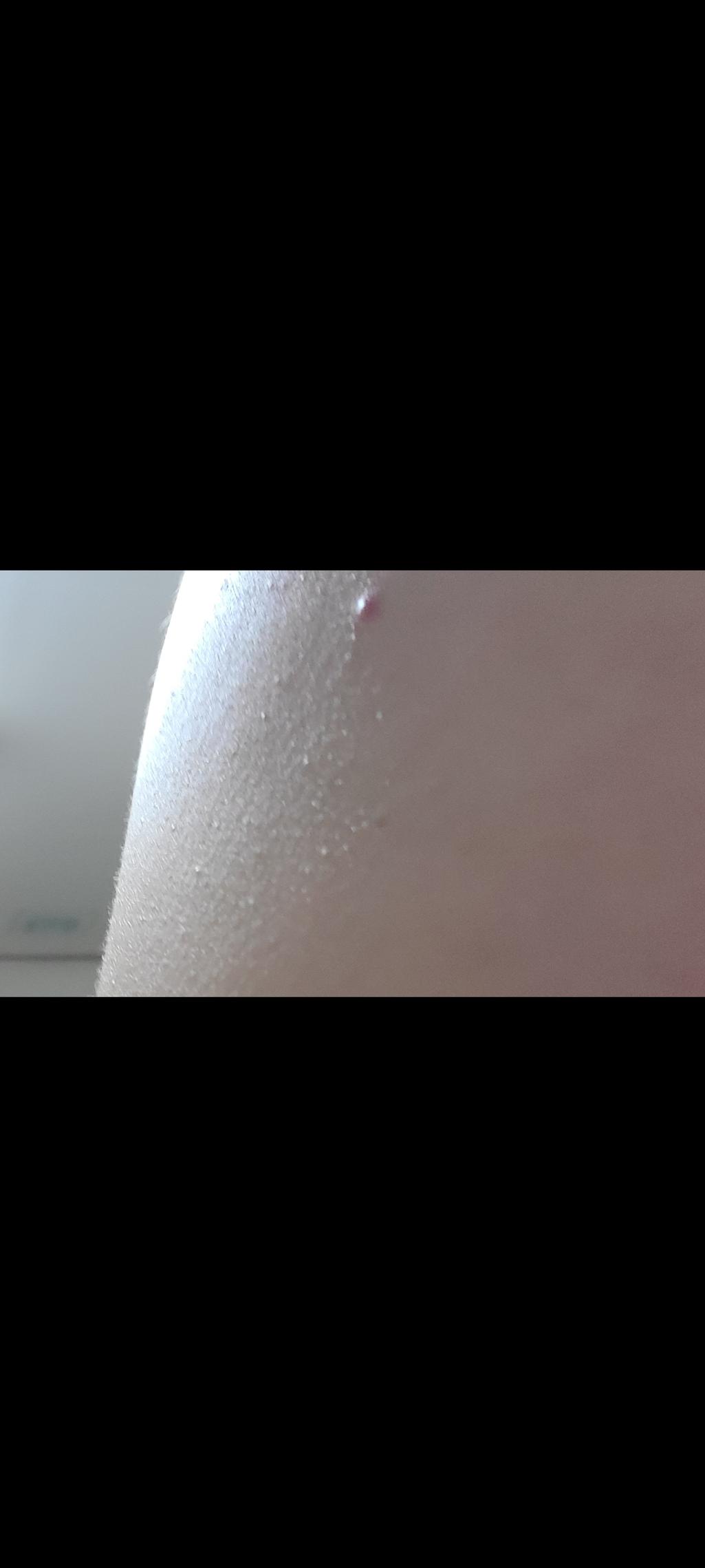 3번 째 사진