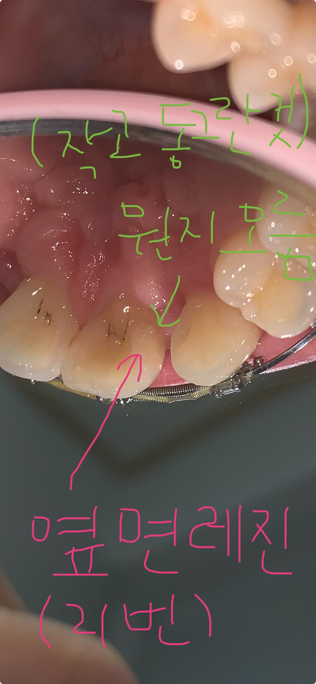 1번 째 사진