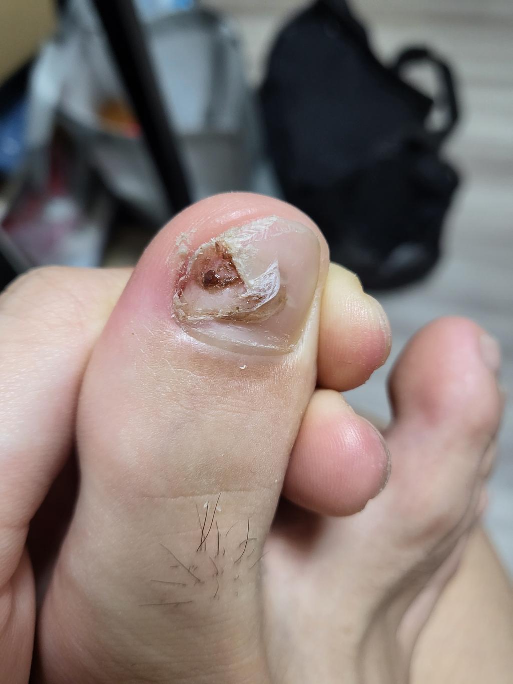 2번 째 사진