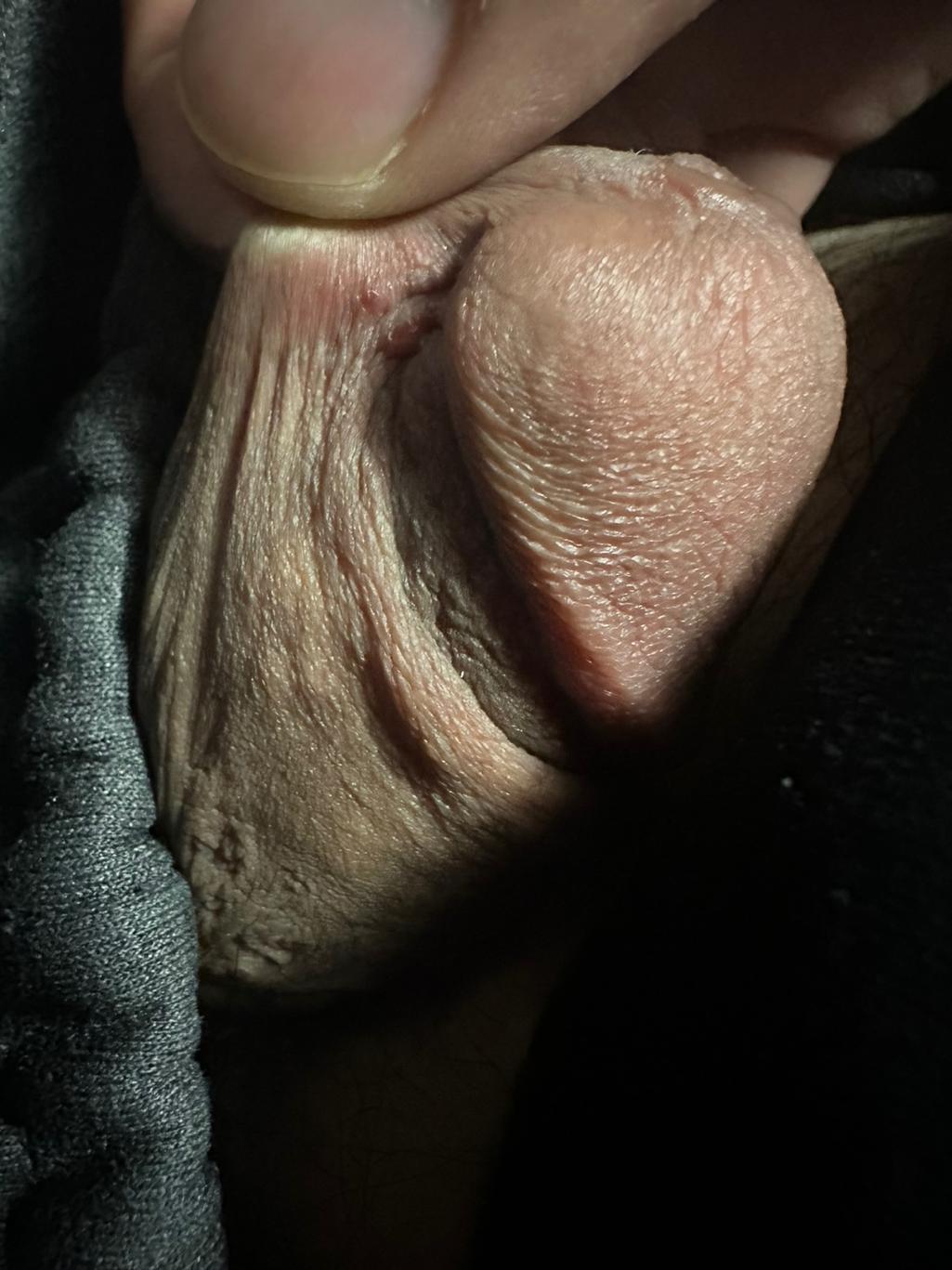 2번 째 사진