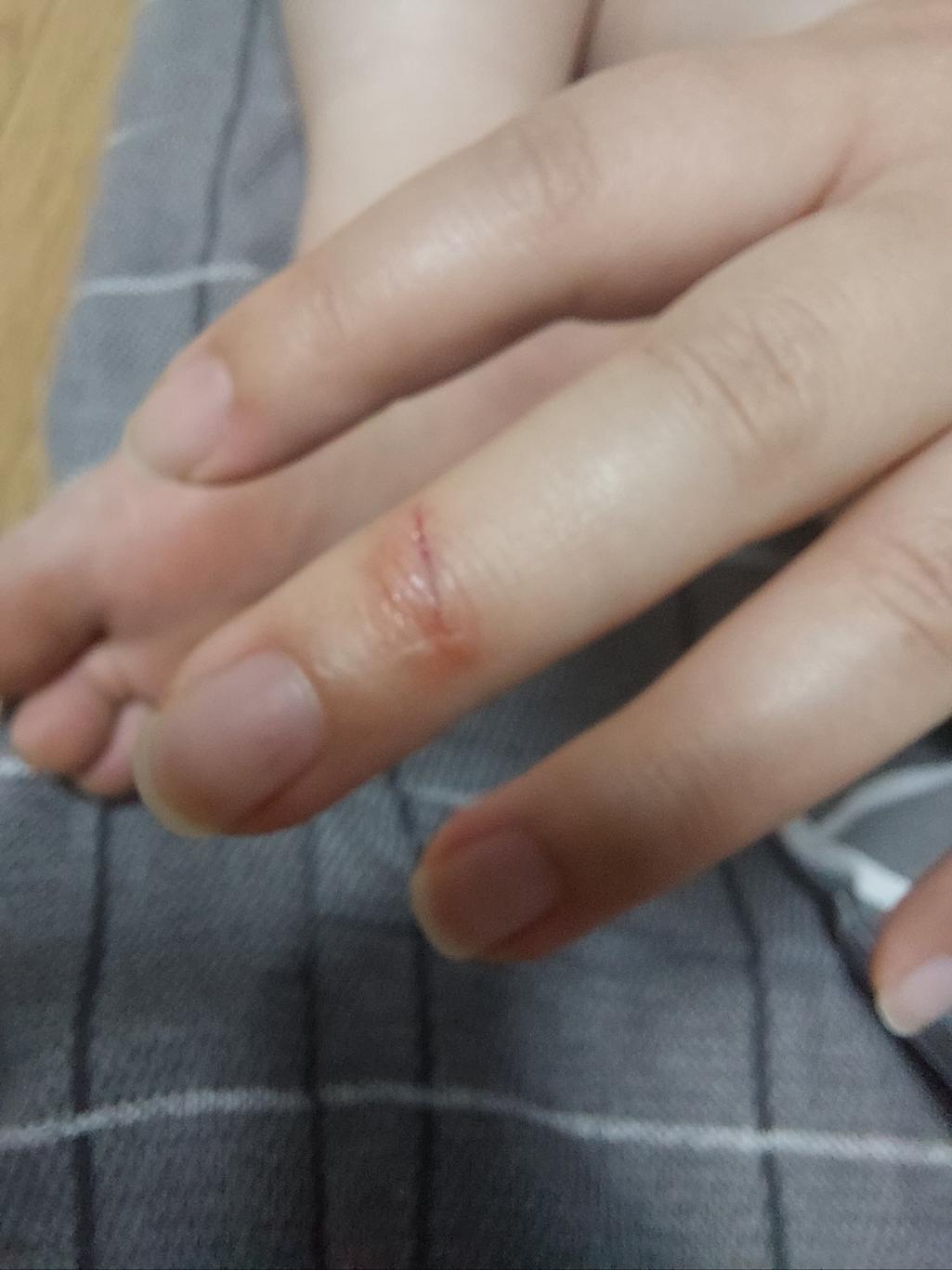 1번 째 사진