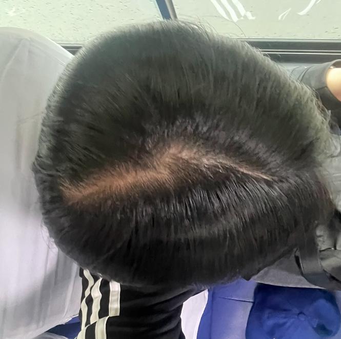 2번 째 사진