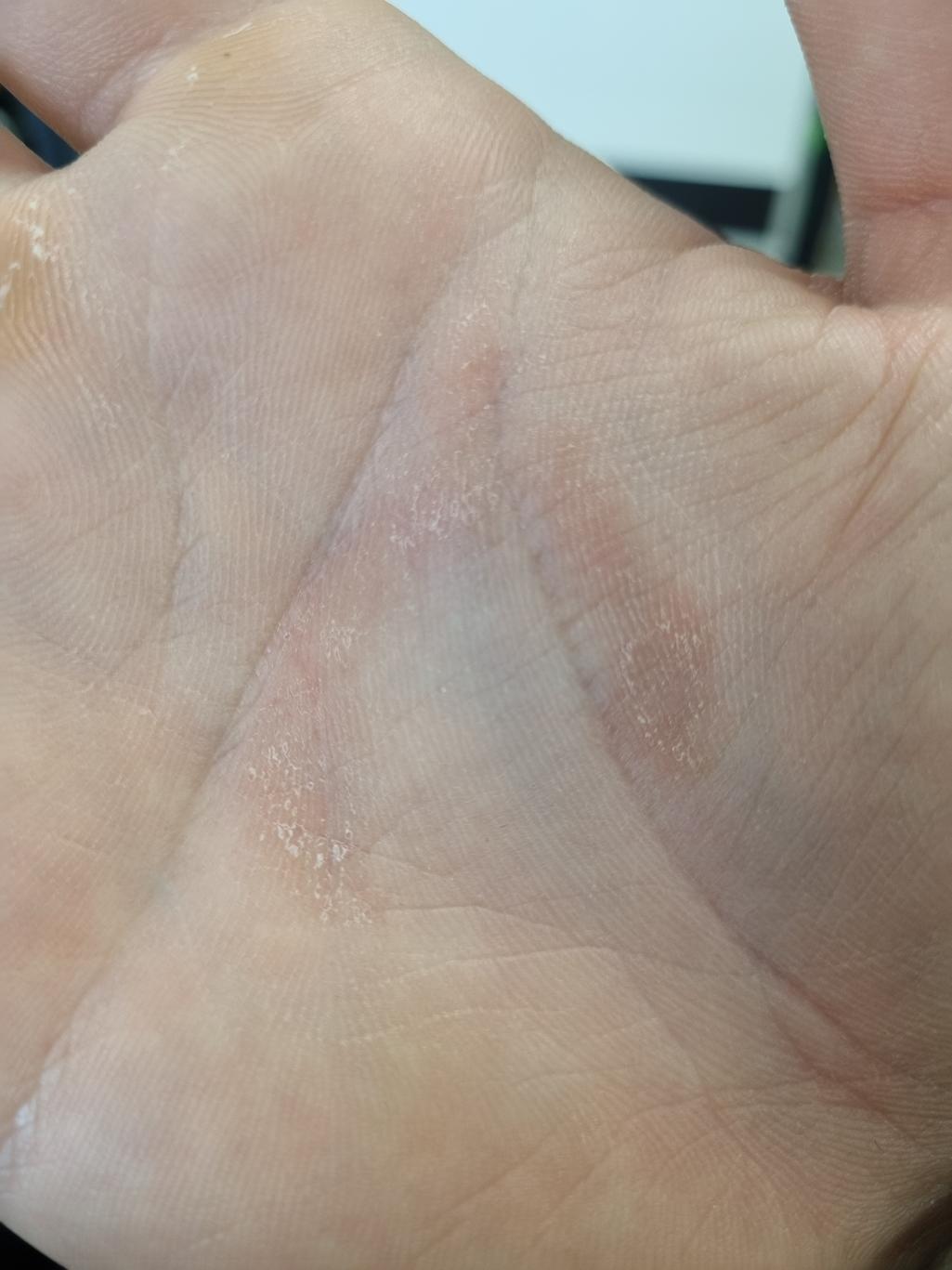 2번 째 사진